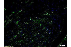 Immunofluorescence (IF) image for anti-Intercellular Adhesion Molecule 1 (ICAM1) (AA 201-300) antibody (ABIN670806)