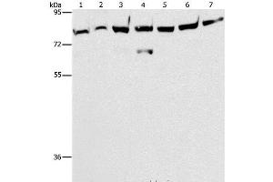 Western Blot analysis of A172 cell and Mouse brain tissue, K562, 231, A549, hela and hepG2 cell using PKC epsilon Polyclonal Antibody at dilution of 1:400 (PKC epsilon antibody)