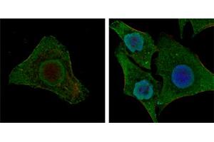Confocal immunofluorescence analysis of MCF-7 (left) and HepG2 (right) cells using BRAF mouse mAb (green).