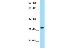 Western Blotting (WB) image for anti-Killer Cell Lectin-Like Receptor Subfamily C, Member 1 (KLRC1) (N-Term) antibody (ABIN2788755) (KLRC1 antibody  (N-Term))