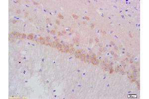 gamma 1 Adaptin antibody  (AA 721-822)