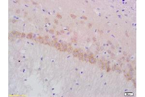 Formalin-fixed and paraffin embedded rat brain labeled with Anti-Gamma-Adaptin Polyclonal Antibody, Unconjugated  at 1:200 followed by conjugation to the secondary antibody and DAB staining
