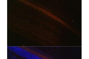 Immunofluorescence analysis of Rat retina using GRK1 Polyclonal Antibody at dilution of 1:100 (40x lens). (GRK1 antibody)