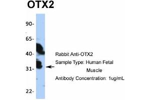 Western Blotting (WB) image for anti-Orthodenticle Homeobox 2 (OTX2) (N-Term) antibody (ABIN2779643)