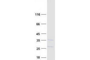 FDX1L Protein (Myc-DYKDDDDK Tag)