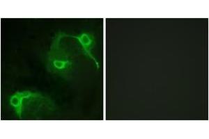 Immunofluorescence analysis of COS7 cells, using VAV2 (Ab-142) Antibody. (VAV2 antibody  (AA 108-157))