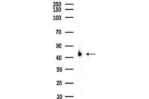 anti-UDP-Gal:betaGlcNAc beta 1,4- Galactosyltransferase, Polypeptide 2 (B4GALT2) (Internal Region) antibody
