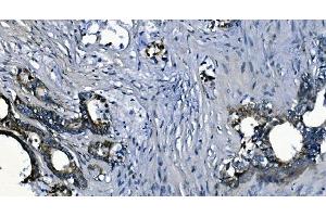 IHC analysis of PCBP2/hnRNP E2 using anti-PCBP2/hnRNP E2 antibody (ABIN7600449). (PCBP2 antibody  (AA 197-276))
