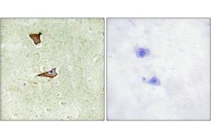 Immunohistochemical analysis of paraffin-embedded human brain tissue using IGF2R (Phospho-Ser2409) antibody (left)or the same antibody preincubated with blocking peptide (right).