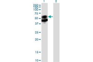 Western Blot analysis of PSAP expression in transfected 293T cell line by PSAP monoclonal antibody (M01), clone 1D1-C12.