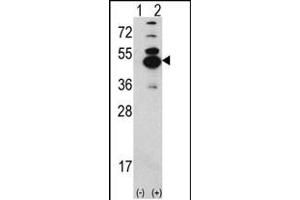 Western blot analysis of CK1D (arrow) using rabbit polyclonal CK1D Antibody (N-term) (ABIN391308 and ABIN2841343). (CAMK1D antibody  (N-Term))