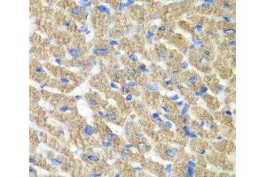 Immunohistochemistry of paraffin-embedded Mouse heart using FIBP Polyclonal Antibody at dilution of 1:100 (40x lens). (FIBP antibody)