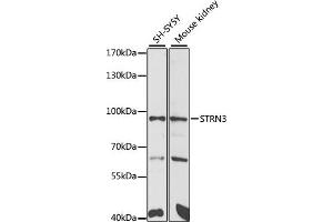 Western blot analysis of extracts of various cell lines, using STRN3 antibody (ABIN6129134, ABIN6148646, ABIN6148648 and ABIN6222490) at 1:1000 dilution. (STRN3 antibody  (AA 200-460))