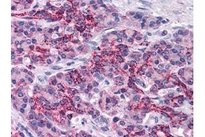 Human Pancreas: Formalin-Fixed, Paraffin-Embedded (FFPE) (XIAP antibody  (AA 75-226))