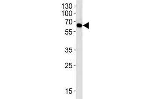 Western blot analysis of lysate from 293 cell line using FYN antibody at 1:1000. (FYN antibody)