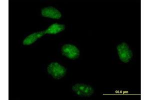 Immunofluorescence of purified MaxPab antibody to EME1 on HeLa cell. (Crossover junction endonuclease EME1 (EME1) (AA 1-583) antibody)