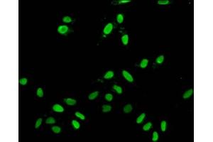 Immunofluorescent analysis of Hela cells using ABIN7139607 at dilution of 1:100 and Alexa Fluor 488-congugated AffiniPure Goat Anti-Rabbit IgG(H+L) (H2AFZ antibody  (meLys7))