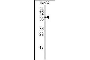 Western blot analysis of anti-ALDH4A1 Antibody in HepG2 cell line lysates (35ug/lane). (ALDH4A1 antibody  (AA 288-314))