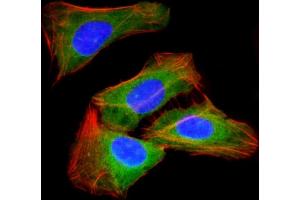 Immunofluorescent analysis of 4 % paraformaldehyde-fixed, 0. (RAB23 antibody)