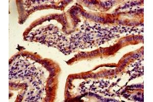 Immunohistochemistry of paraffin-embedded human duodenum tissue using ABIN7163465 at dilution of 1:100 (PITX2 antibody  (AA 40-154))