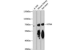 Western blot analysis of extracts of various cell lines, using NTN4 antibody (ABIN6128371, ABIN6144901, ABIN6144902 and ABIN6217888) at 1:3000 dilution. (Netrin 4 antibody  (AA 290-520))