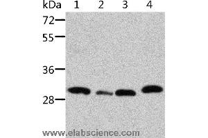 Western blot analysis of Mouse pancreas and spleen tissue, mouse heart tissue and 293T cell, using STRADB Polyclonal Antibody at dilution of 1:500 (STRADB antibody)