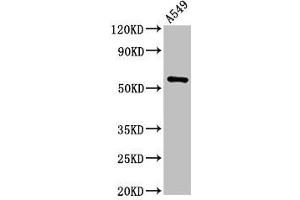 Western Blot Positive WB detected in: A549 whole cell lysate All lanes: TRIM21 antibody at 2 μg/mL Secondary Goat polyclonal to rabbit IgG at 1/50000 dilution Predicted band size: 55, 46 kDa Observed band size: 55 kDa (TRIM21 antibody  (AA 1-475))