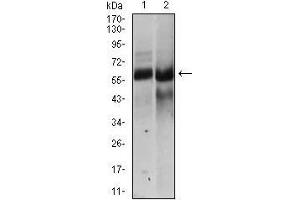 Western blot analysis using HAS2 mouse mAb against NTERA-2 (1), HEK293 (2) cell lysate. (HAS2 antibody  (AA 67-170))