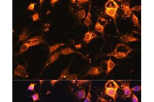 Immunofluorescence analysis of C6 cells using DRP1 Polyclonal Antibody at dilution of 1:100.