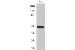 Western Blotting (WB) image for anti-Caspase 9, Apoptosis-Related Cysteine Peptidase (CASP9) (pThr125) antibody (ABIN3182484) (Caspase 9 antibody  (pThr125))
