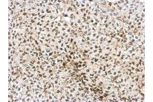 IHC-P Image Immunohistochemical analysis of paraffin-embedded D54 xenograft, using AF9, antibody at 1:750 dilution. (AF9 antibody  (Center))