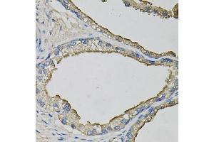 Immunohistochemistry of paraffin-embedded human prostate using LCN1 antibody. (Lipocalin 1 antibody)
