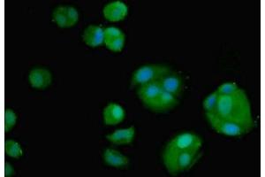 Immunofluorescent analysis of MCF-7 cells using ABIN7160302 at dilution of 1:100 and Alexa Fluor 488-congugated AffiniPure Goat Anti-Rabbit IgG(H+L) (AMH antibody  (AA 26-560))