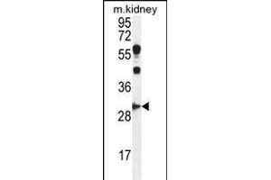 CCNG1 Antibody (C-term) (ABIN655159 and ABIN2844777) western blot analysis in mouse kidney tissue lysates (35 μg/lane). (Cyclin G1 antibody  (C-Term))