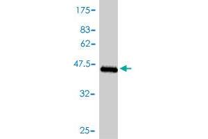 Western Blot detection against Immunogen (43. (TNNC1 antibody  (AA 1-161))