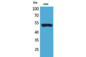 Western Blotting (WB) image for anti-Keratin 8 (KRT8) (Ser726), (Ser731) antibody (ABIN3187841) (KRT8 antibody  (Ser726, Ser731))