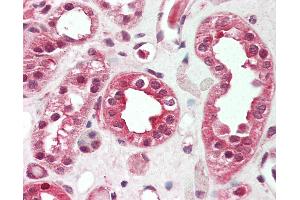 Human Kidney: Formalin-Fixed, Paraffin-Embedded (FFPE). (Sclerostin antibody  (AA 38-87))