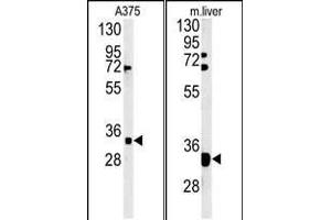 (LEFT)Western blot analysis of FYTD1 Antibody (N-term) (ABIN651416 and ABIN2840226) in  cell line lysates (35 μg/lane). (FYTTD1 antibody  (N-Term))