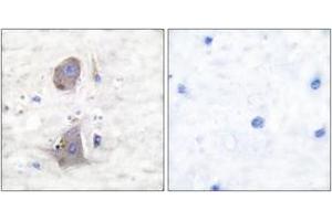 Immunohistochemistry analysis of paraffin-embedded human brain tissue, using GLUT1 Antibody. (GLUT1 antibody  (AA 441-490))