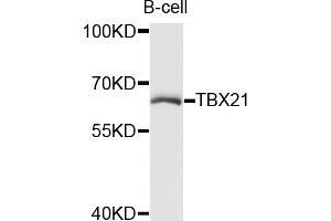 Western blot analysis of extracts of B-cell cells, using TBX21 antibody (ABIN5972689) at 1/1000 dilution. (T-Bet antibody)