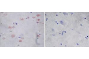 Immunohistochemistry analysis of human brain tissue slide (Paraffin embedded) using Rabbit Anti-Parkin Polyclonal Antibody (left, ABIN398785) and Purified Rabbit IgG (whole molecule) Control (right, ABIN398653) (Parkin antibody  (AA 300-350))