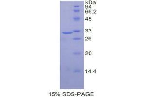 SDS-PAGE (SDS) image for Calpain 1 (CAPN1) (AA 75-343) protein (His tag) (ABIN1169977)