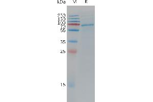 Cynomolgus A Protein, His Tag on SDS-PAGE under reducing condition.