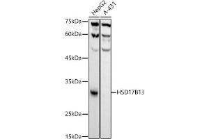 Western blot analysis of extracts of various cell lines, using HSD17B13 antibody (ABIN7267809) at 1:1000 dilution. (HSD17B13 antibody)