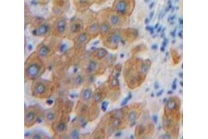 Used in DAB staining on fromalin fixed paraffin-embedded Liver tissue (SHB antibody  (AA 248-484))