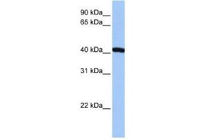 FTSJ1 antibody used at 1 ug/ml to detect target protein. (FTSJ1 antibody)