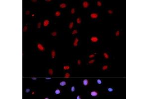 Immunofluorescence analysis of U2OS cells using Phospho-MAP2K6(S207)/MAP2K3(S189) Polyclonal Antibody (MAP2K6 antibody  (pSer189, pSer207))
