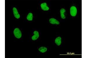 Immunofluorescence of monoclonal antibody to POLD3 on HeLa cell. (POLD3 antibody  (AA 357-466))