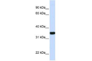 GAPDH antibody used at 1 ug/ml to detect target protein. (GAPDH antibody  (N-Term))