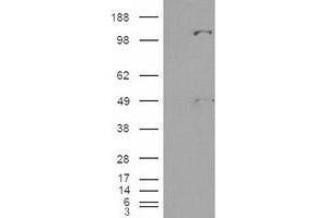 Image no. 2 for anti-Pyruvate Carboxylase (PC) (Internal Region) antibody (ABIN374944) (PC antibody  (Internal Region))